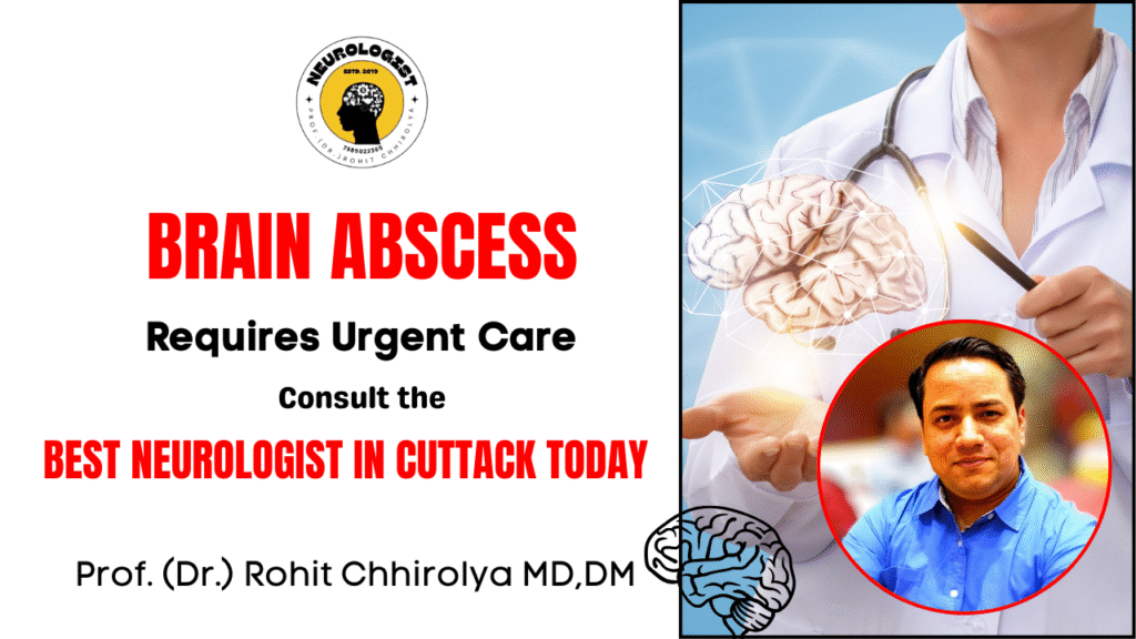 Brain Abscess