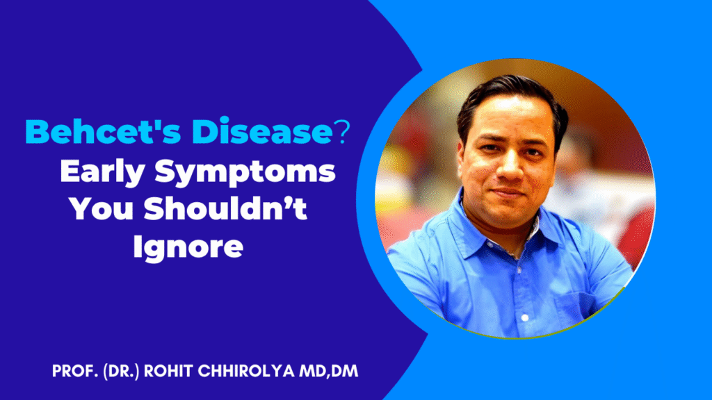 Behcet's Disease